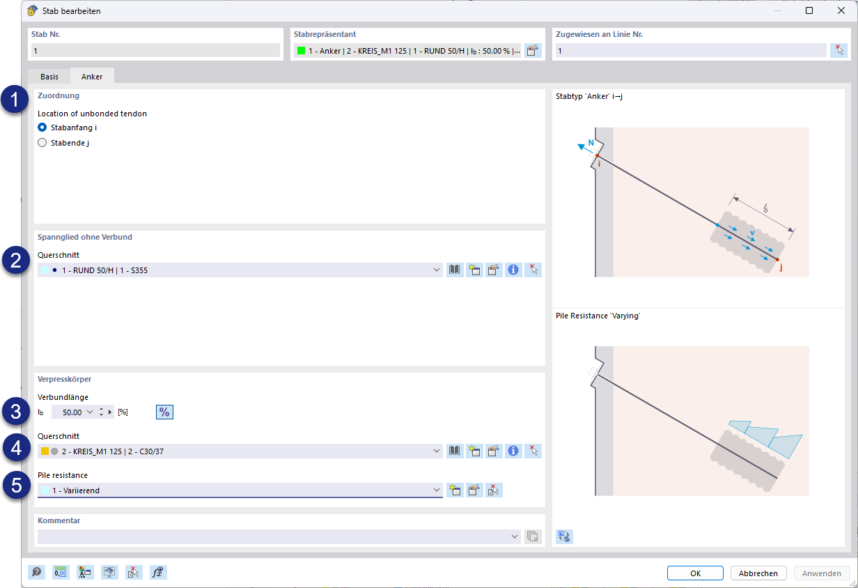 Registerkarte "Anker" im Stäbe-Dialog mit Auswahlfeldern für Spanngliedeinstellungen.