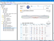 Documentation des résultats dans le rapport d’impression
