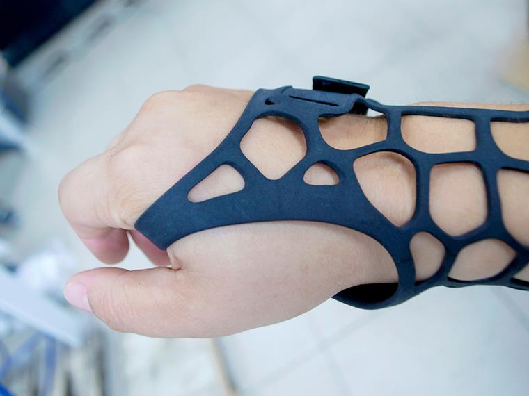 Печатные протезы на 3D принтере